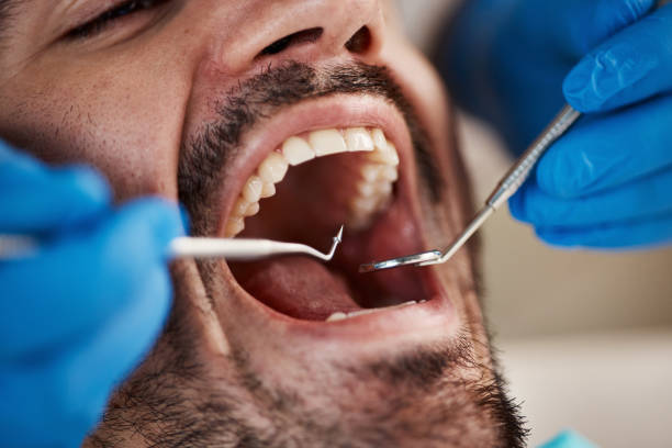 Best Tooth Infection Emergency Dentist  in Albion, MI
